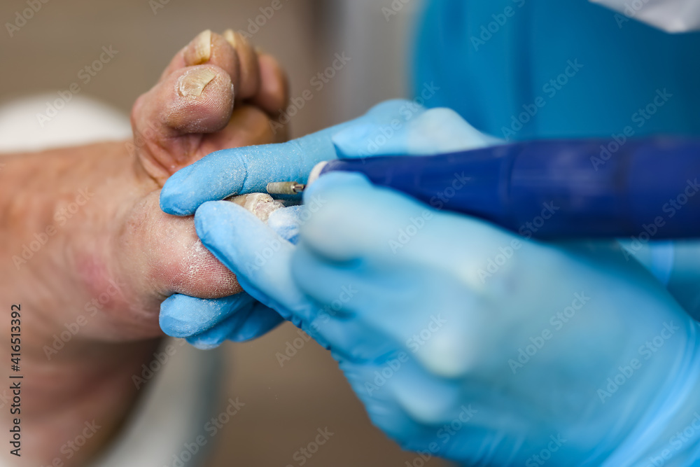 pedicure master in mask and goggles, polishes toenails close-up. Caring for the health of the legs and feet. Prepare open shoes for the summer. Relief from the pain of discomfort when walking pedicure master in mask and goggles, polishes toenails close-up. Caring for the health of the legs and feet. Prepare open shoes for the summer. Relief from the pain of discomfort when walking
