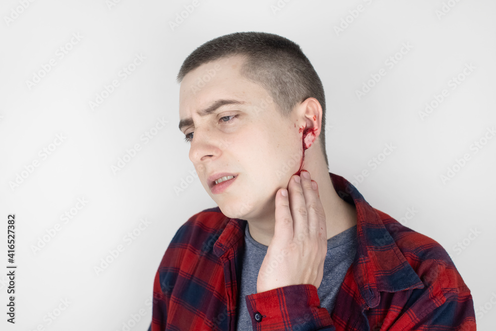 A man whose ear is bleeding. Vascular rupture, damage to the tympanic membrane, ear diseases, oncology, otitis media, myringitis A man whose ear is bleeding. Vascular rupture, damage to the tympanic membrane, ear diseases, oncology, otitis media, myringitis
