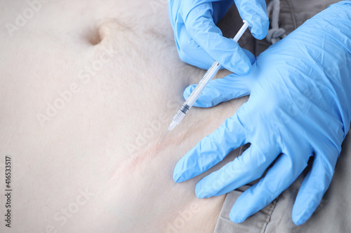 Nurse injecting medicine into patients postoperative scar closeup photo