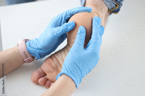Canvas Print Doctor dermatologist in gloves examining patients heel closeup