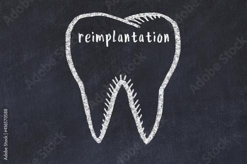 Chalk drawing of a tooth with medical term reimplantation. Concept of learning stomatology photo