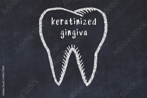 Chalk drawing of a tooth with medical term keratinized gingiva. Concept of learning stomatology photo