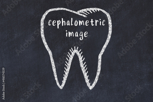 Chalk drawing of a tooth with medical term cephalometric image. Concept of learning stomatology photo