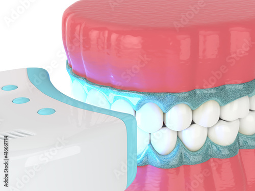  3d render of jaw with teeth bleaching by uv lamp