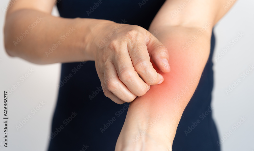 Itching of skin diseases in women using the hand-scratching. Red around the Itching area. Concept with Healthcare And Medicine. Itching of skin diseases in women using the hand-scratching. Red around the Itching area. Concept with Healthcare And Medicine.