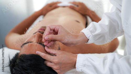 Close-up of a man's face treated by a Chinese alternative medicine, acupuncture facial therapy in a spa. Acupuncture needle.