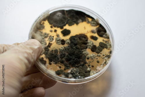 hand holding a petri dish with bacteria, close up shot