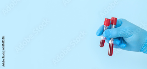 Researcher holding blood sample flasks of patients in laboratory