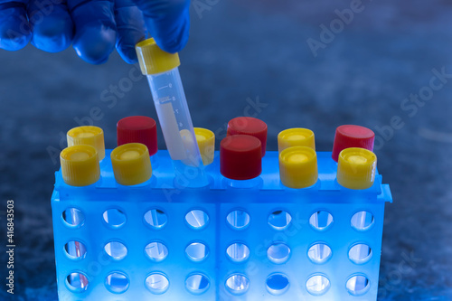 Close-up, a scientist with a gloved hand pulls a test tube with a yellow stopper from a blue tripod. The tripod is illuminated with blue light from below.