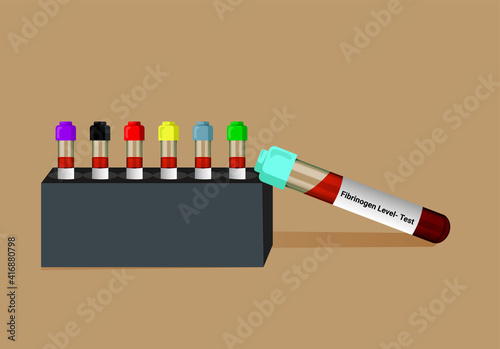 Blood sample for fibrinogen level (factor 1) test, diagnosis of coagulation disorder test. A medical testing concept with tube vector in the laboratory background.