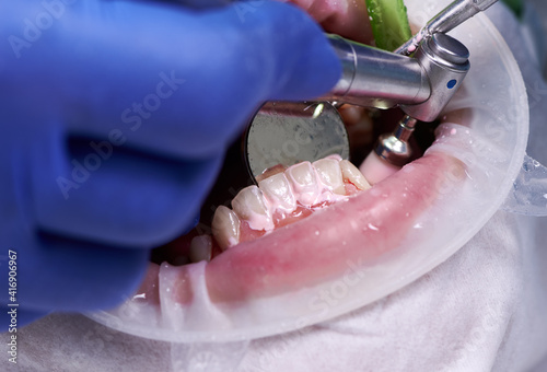 Close up of periodontist using dental polisher and mirror cleaning teeth of patient, with cheek retractor in mouth, polishing in dental clinic. Concept of professional dental hygiene photo