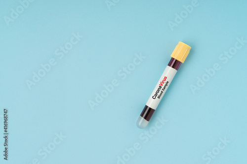 Blood sample vacuum tube on blue background with a copy space. Corona virus concept. Flat lay.