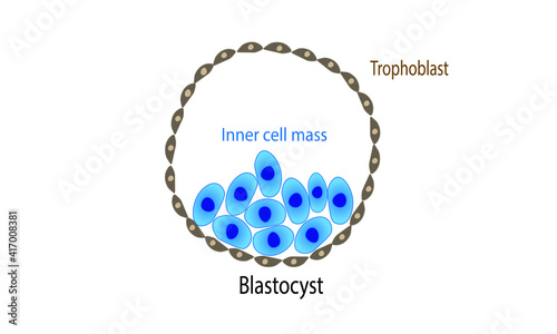 Blastocyst 