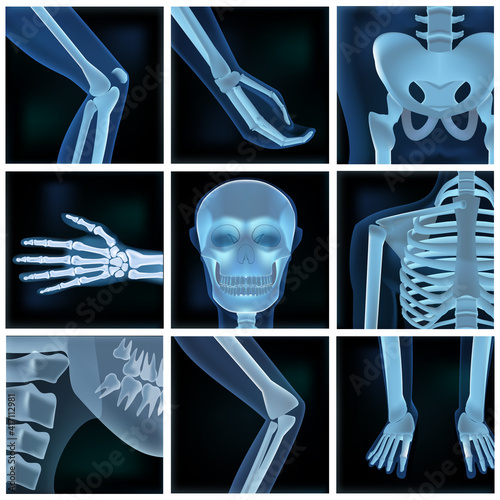 Collage Of Many X-rays Photos Parts Of A Man