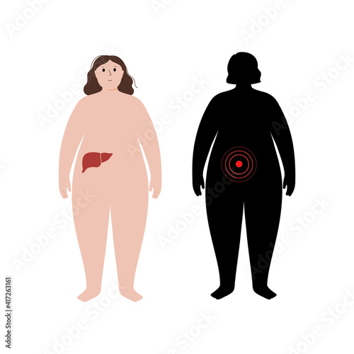 Organs in obese human body