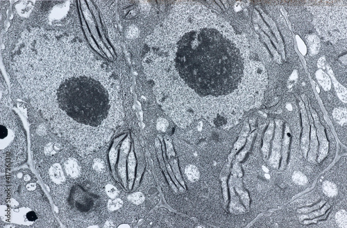 Fotografía Electron microscopy of a vegetal cell showing chloroplast, nucleus, nucleole and
