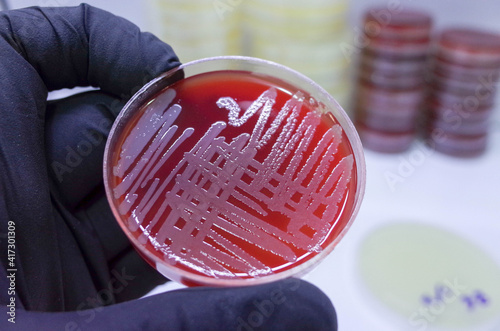 bacterial growth on culture media in petri dish  photo