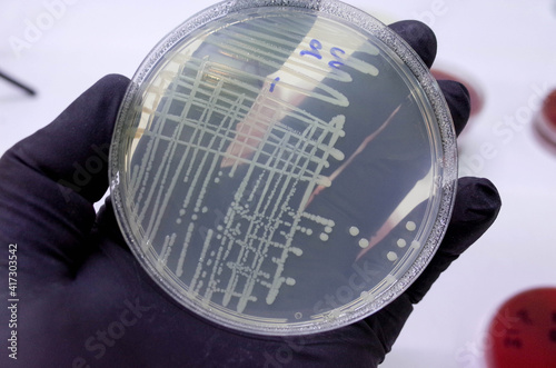 bacterial growth on culture media in petri dish  photo