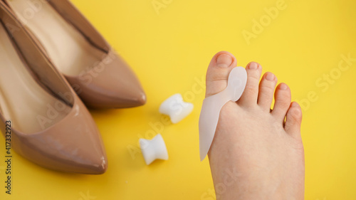 Treatment and prevention of hallux valgus. Silicone finger separator. Legs on a yellow background. Shoes on a blurred background