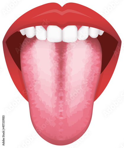 Tongue’s health sign vector illustration ( White coated Tongue )