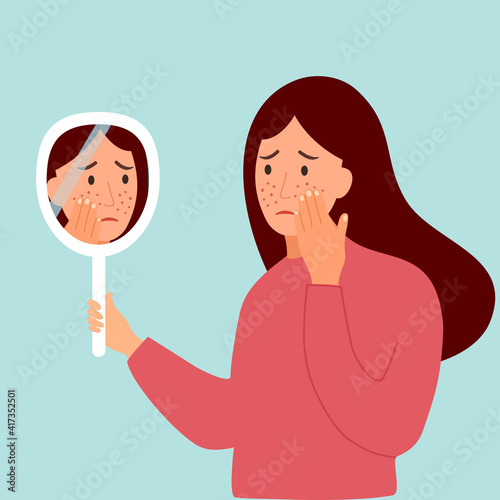 Young woman hand mirror worrying about her acne on face in flat design. Pimple problem on female skin.