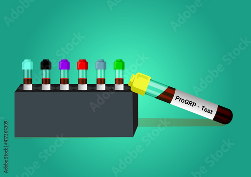 Blood sample for ProGRP (Gastrin-releasing peptide) test. Marker for small cell lung cancer. A medical testing concept with tube vector in the laboratory background.