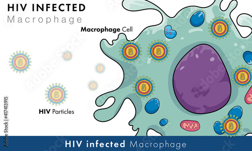 Macrophage phagocytic immune cell infected with human immune deficiency virus, HIV retro virus causes AIDS biomedical illustration. 