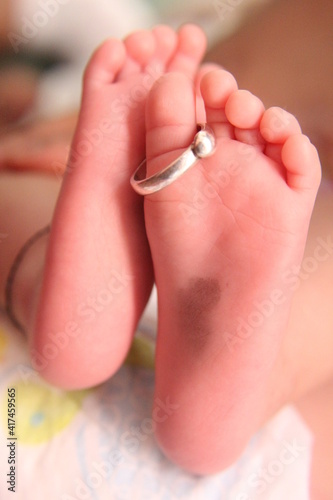 Wedding rings on the little legs of a newborn baby.
