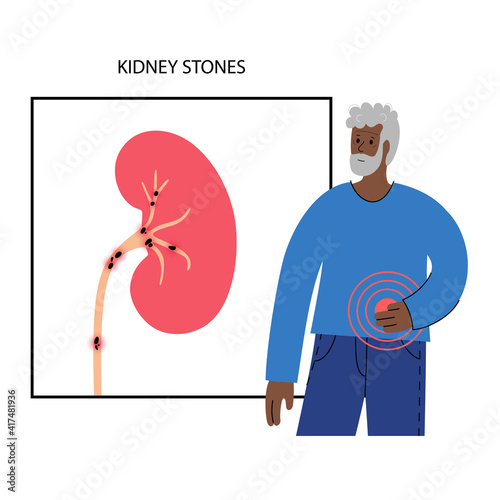 Kidney disease concept
