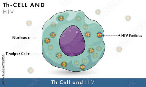 HIV infected T helper cell.