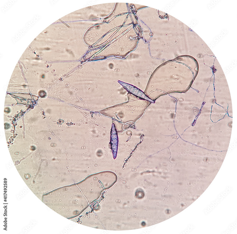 Microscopic finding shows macroconidia of Microsporum canis in dog with  skin disease. a ringworm infection in pets. Stock Photo | Adobe Stock