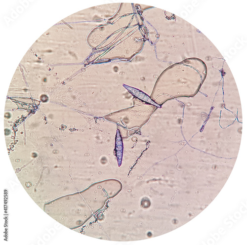 Microscopic finding shows macroconidia of Microsporum canis in dog with skin disease. a ringworm infection in pets. photo