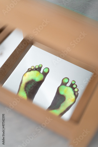 Foot examination - close up. Orthopedics, foot podoscope test. Barefoot footprint test. photo