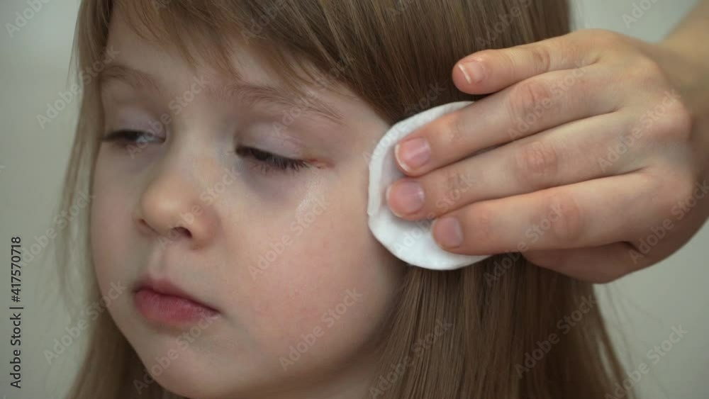 Close up of mothers hands apply sterile cotton ball of antispeptic to