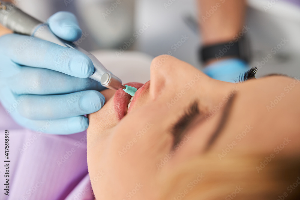Prophy cup touching tooth in female mouth Prophy cup touching tooth in female mouth