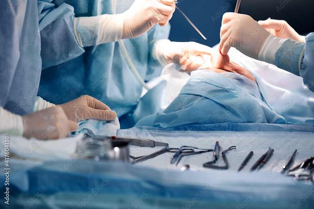 rhinoplasty, the real operation from the side has become with instruments. Doctor in gloves holds a medical instrument during rhinoplasty rhinoplasty, the real operation from the side has become with instruments. Doctor in gloves holds a medical instrument during rhinoplasty
