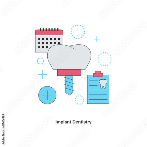 Dental services concept. Implant dentistry.
