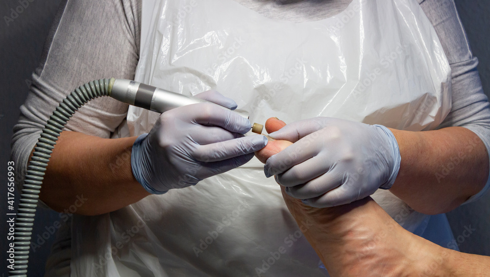 Medizinische Fußpflege-Behandlung beim Mann