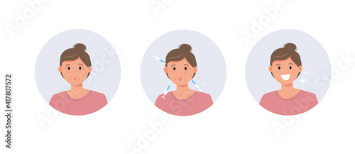 Cosmetic procedure. Before and after. Facial injections against wrinkles and aging. Beauty treatments. Cartoon vector illustration.