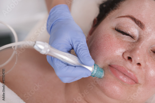 Top view close up of plus size woman enjoying vacuum pores cleanse at beauty salon