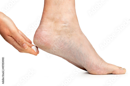 Cropped shot of care for dry skin on the well-groomed feet and heels with creams for the skin and feet