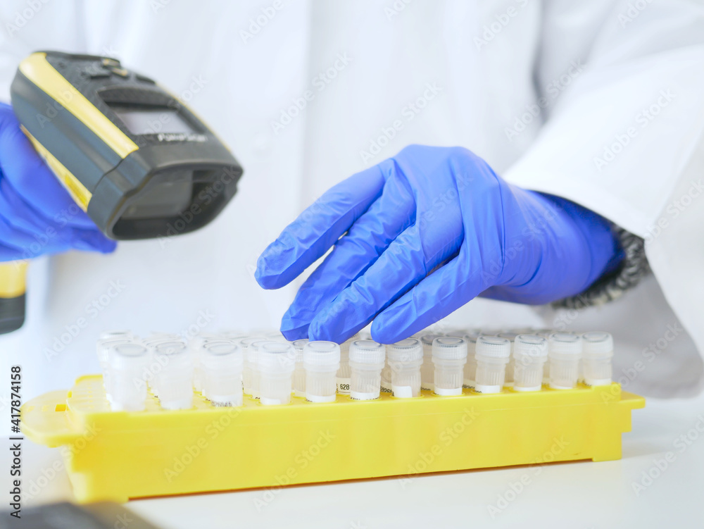 Lab technician or medical assistant scans patient samples into the patient database. laboratory technician uses barcode reader. genetic and cancer screening and medical technology and therapy.