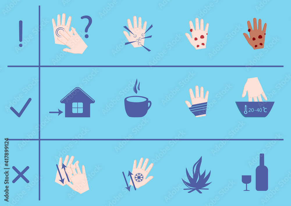 Fototapeta premium Frostbite infographics. Symptoms, protection and first aid. Medical frostbite stage. Hypothermia in winter season. Set of hypothermia vector icons for web design isolated on white background