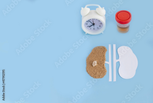 a model of a human kidney made of paper and sand with a stone, a clock, a jar with urine tests on a blue background. kidney health concept