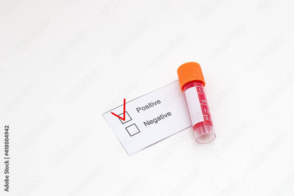 Obraz premium Positive test and laboratory sample of blood testing tube.
