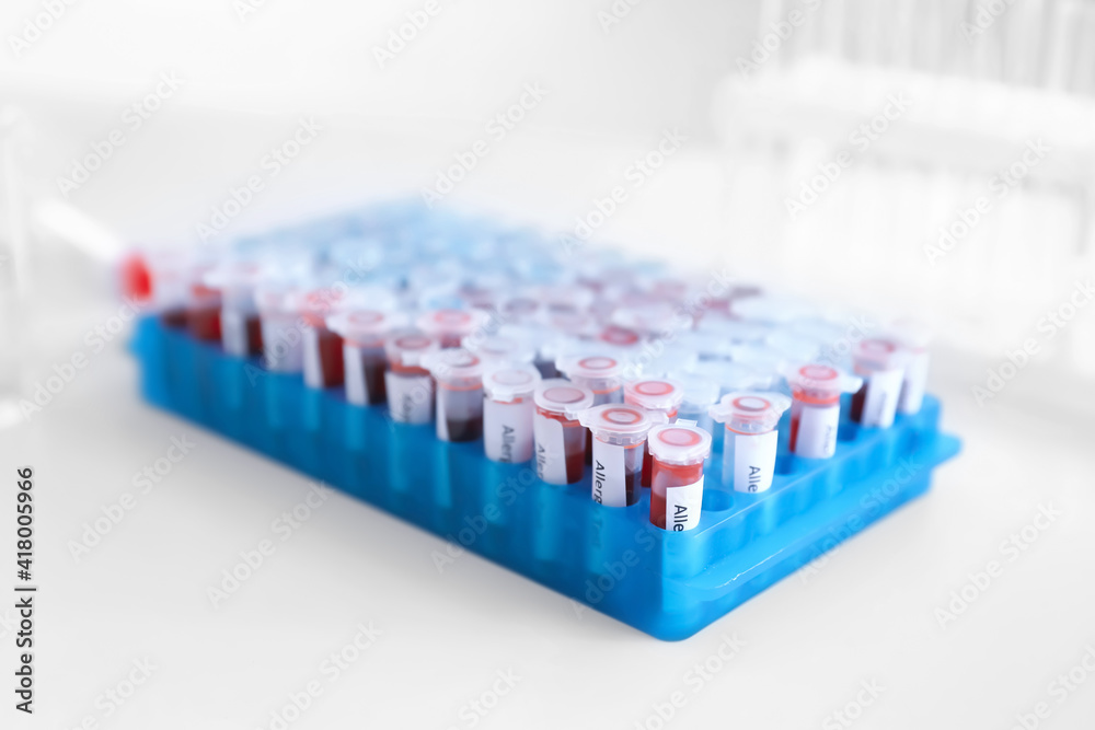 Allergy tests on table in laboratory Allergy tests on table in laboratory