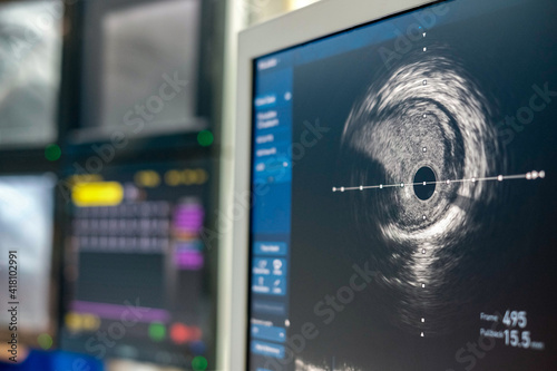 Intravascular ultrasound imaging (IVUS) at cardiac catheterization laboratory room.	 photo