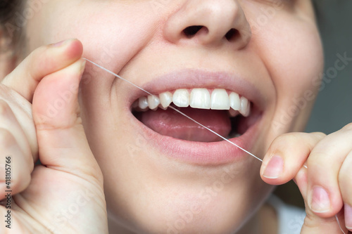 Close-up of female teeth. A Young beautiful woman cleans her teeth with dental floss. Dental concept