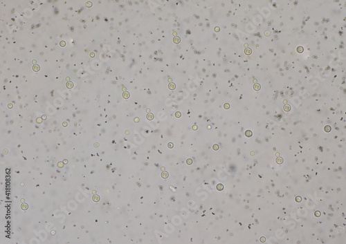 Cryptococcus neoformans is an encapsulated yeast India ink preparetion. photo