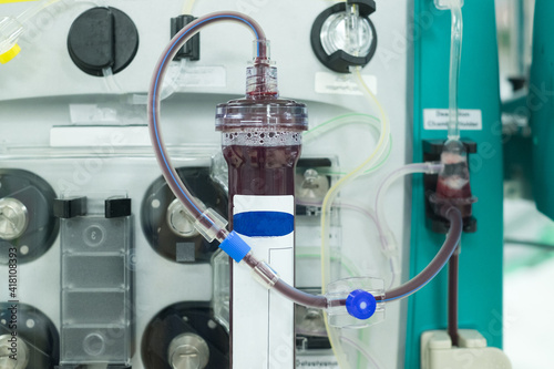  Hemodialysis machine (or hemofiltration procedure). Equipment for kidney failure in intensive care unit photo